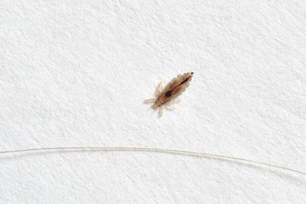 prophetic medicine for head lice